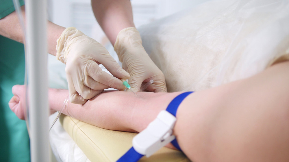 How Does IV Therapy Speed Up Hangover Recovery?
